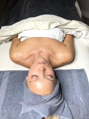 Glowing skin after dermaplane