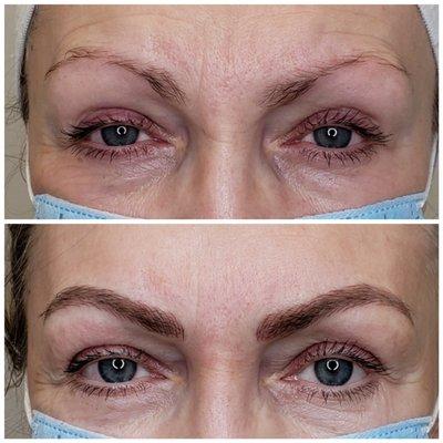 Microblading