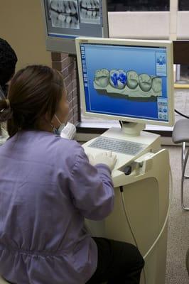 CEREC CAD/CAM technology.