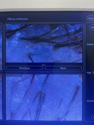 Trichoscopy analysis