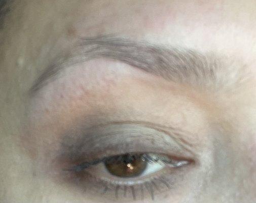 Right eyebrow ALSO in 2nd visit! CLEARLY not the same!