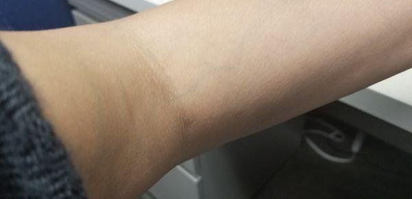 Arm to show that veins are visible