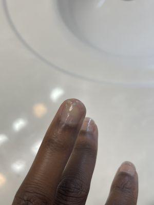 My nail is split in half