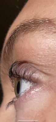 Bag lash lift