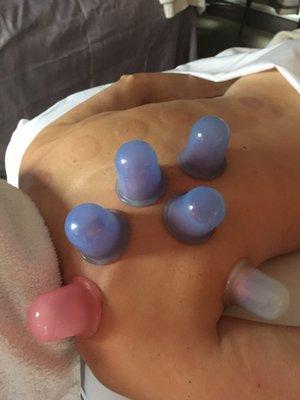 Massage cupping