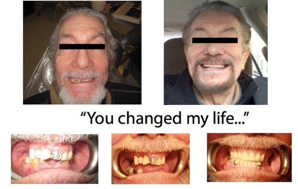 Full mouth rehabilitation! Extremely happy patient !