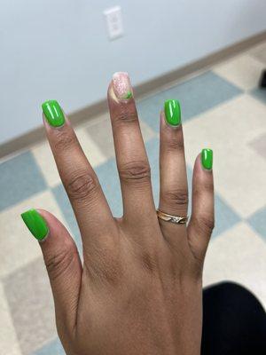 Nail infection + treatment