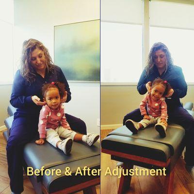 Pediatric chiropractor los angeles for childhood milestones