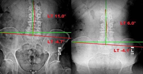 Spinal Correction Centers