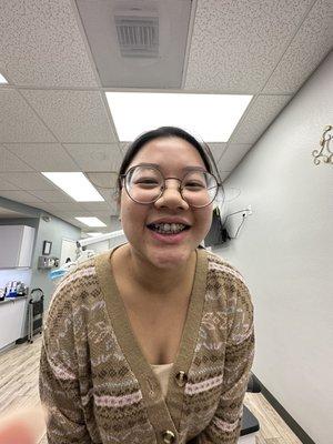 My first day with braces! (Jan 2023)