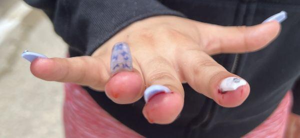 You can see how her nails it's lift up ‍