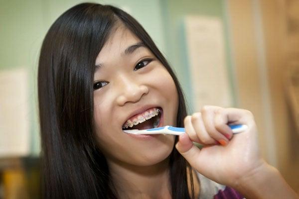 Braces for children, teens and adults