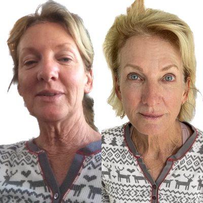 Left photo taken 2014...Right photo taken 2023...First I'm 54 , second 62...No makeup and untouched...