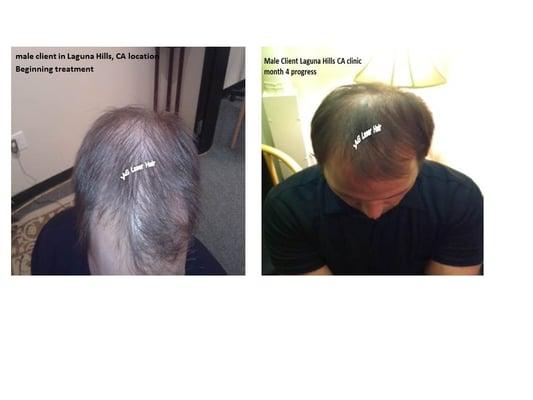 male client after 4 months