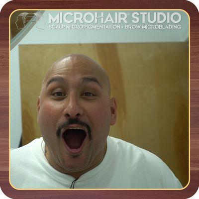 Microhair Studio: Scalp Micropigmentation, LIFE LIKE RESULTS, SHORT RECOVERY TIME, NON-SURGICAL.