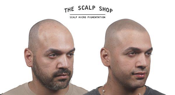 Igor Scalp Micro Pigmentation results. Mens hair loss hair tattoo.