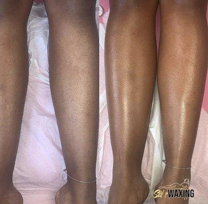 Leg wax before and after