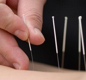 Go see Daniel if you want to get acupuncture!  You won't be disappointed!