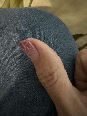 Dip nail that shows manicure that dead skin wasn't even removed ‍