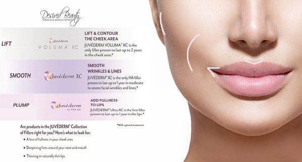 #Juvederm #Fillers #LookGoodFeelGood