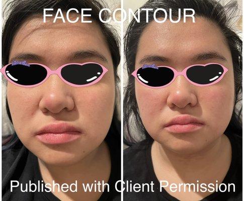 Face Contour