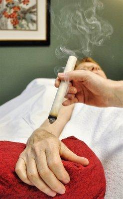 Moxibustion