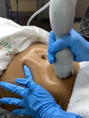 Therma Lift- Noninvasive Face Lift & Full Body Skin Tightening