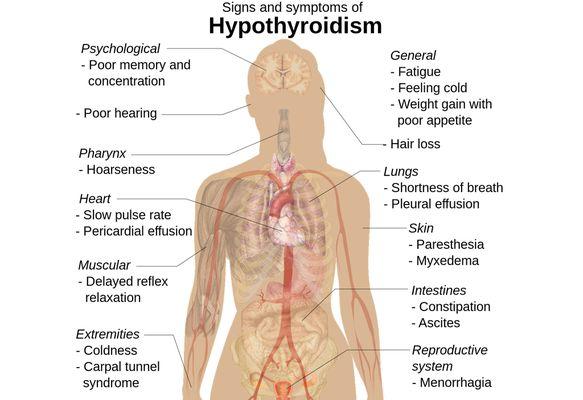 Hypothyroidism Treatment Center