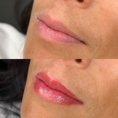 Before and after Lip Blushing session