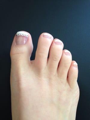 Lost 70% of my big toe nail- somehow, they made it look AMAZING!!