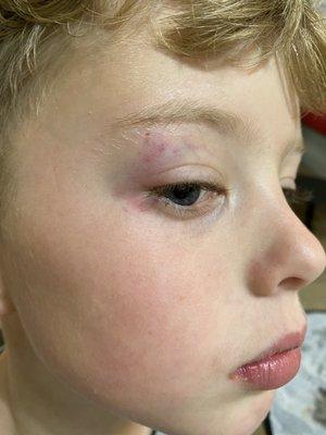 Sons black eye due to neglect in safety measures