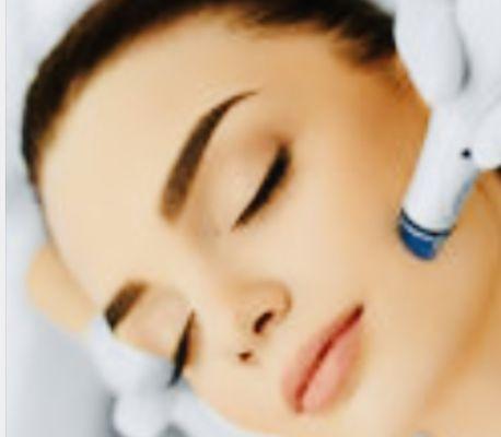 Microdermabrasion