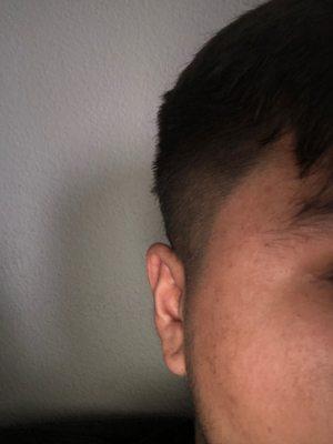 Uneven haircut