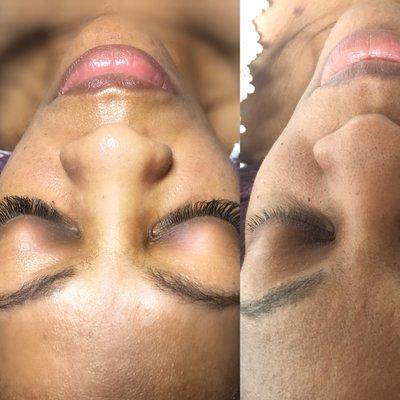 Eyelash extension