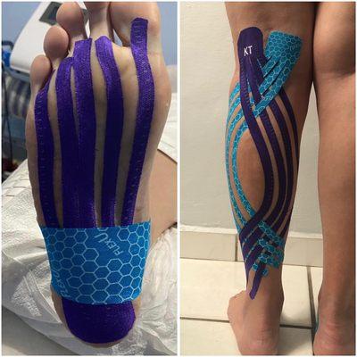 Kinesio Tape, helps to reduce swelling and edema