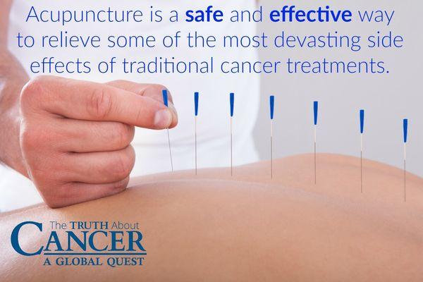 "Acupuncture can relieve many of the devastating effects of traditional cancer treatments"