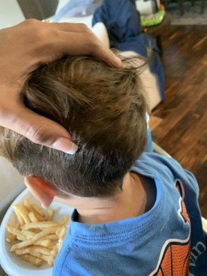 The baseball knot sized bump on my son's head.