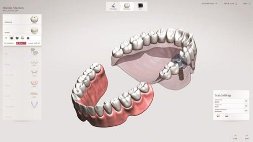 Trios scanner can truly duplicate your mouth