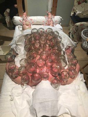 Completely reset your mind, body and soul with a cupping session.