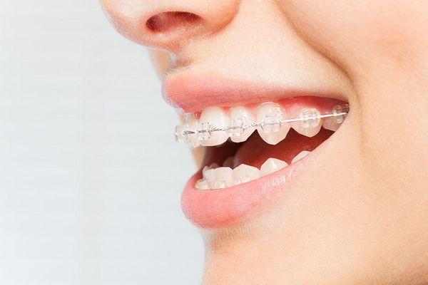 Excellent Cosmetic Dentistry Service in NC