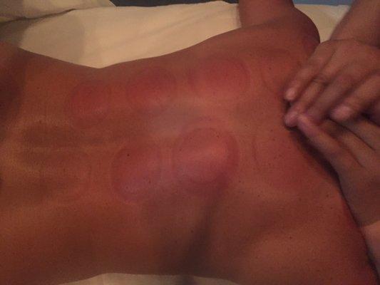 Relaxing massage after cupping