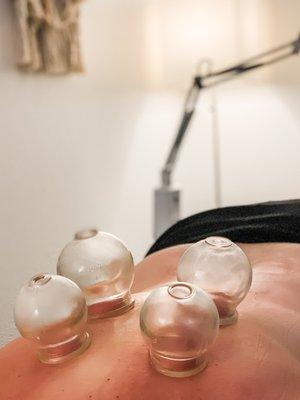 Cupping for back pain and tightness.