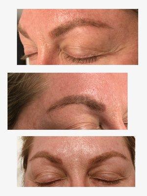 Tattoo Removal with the PiQ04. (3 sessions).  Eyebrows 200.00 per session.