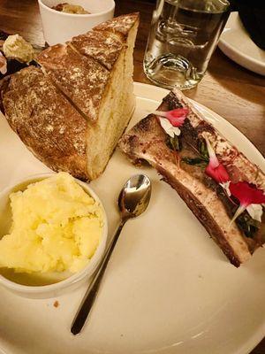 Bone marrow