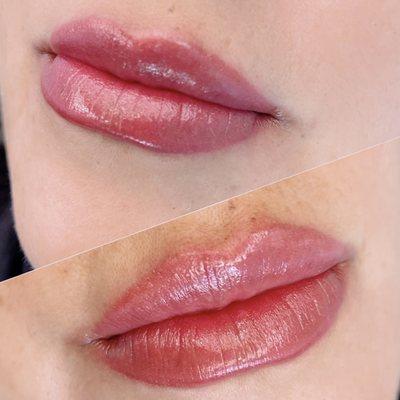 Lip Blushing with neutralization and reshape to even out asymmetry and uneven 3D lip surface.