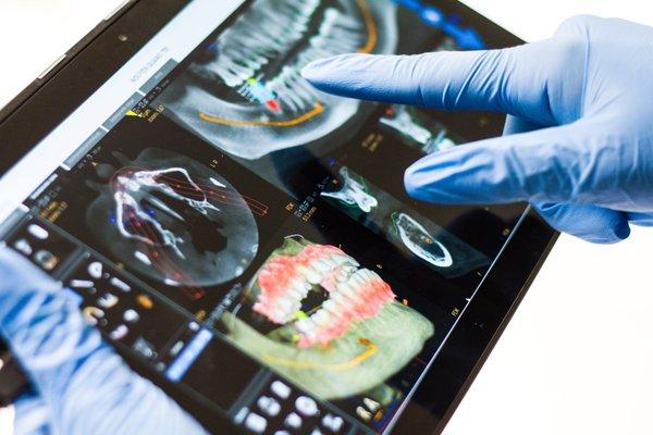 Digital radiographs to minimize x-ray exposure