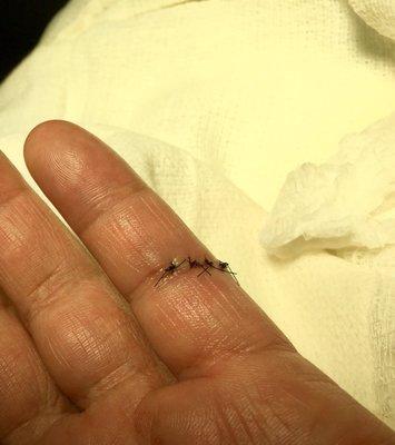 My 4 stitches!