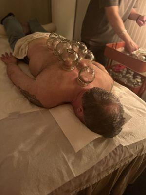 cupping