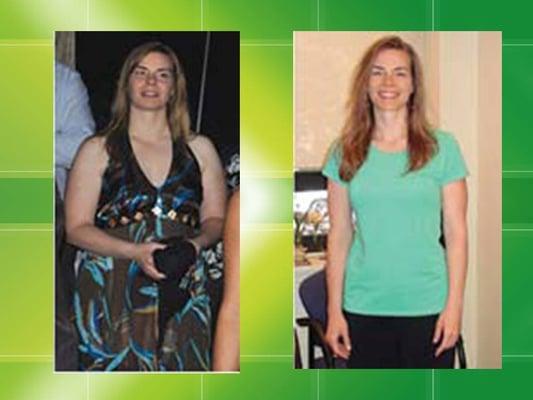 Rockville Weight Loss!  Dr. Miller's before and after photos.