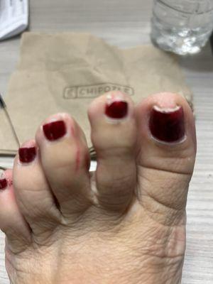 Horrible pedi job